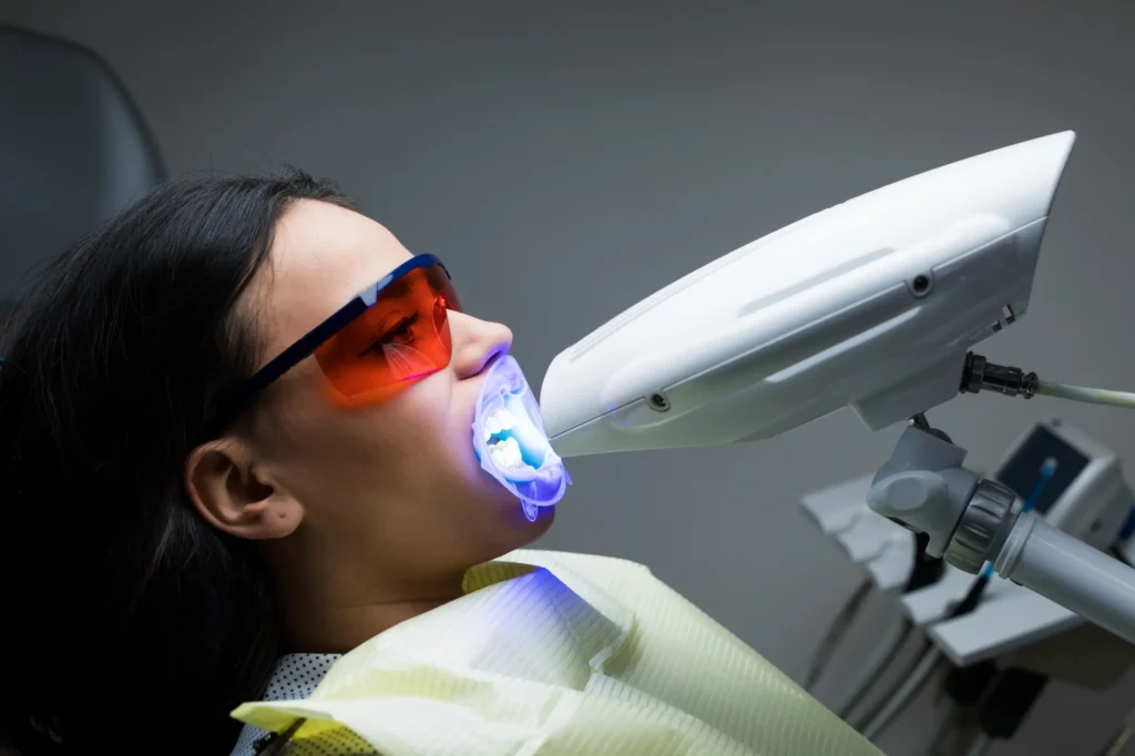 Como escolher o melhor tratamento de clareamento dental