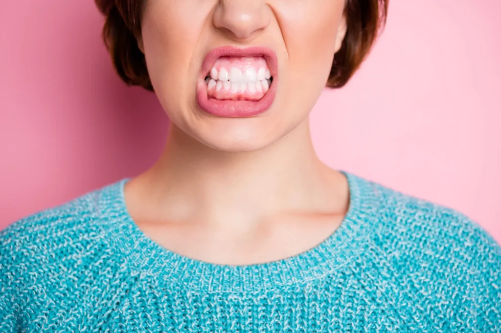 Gengivoplastia: o que esperar antes, durante e depois do procedimento?