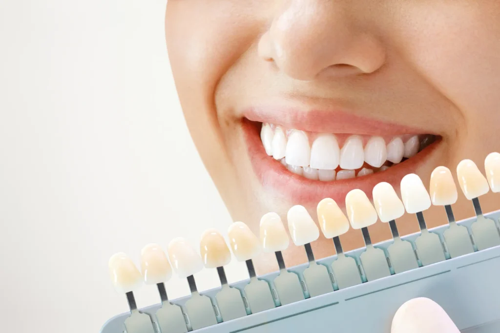 A cor dos dentes diz muito sobre sua saúde: quando se preocupar?