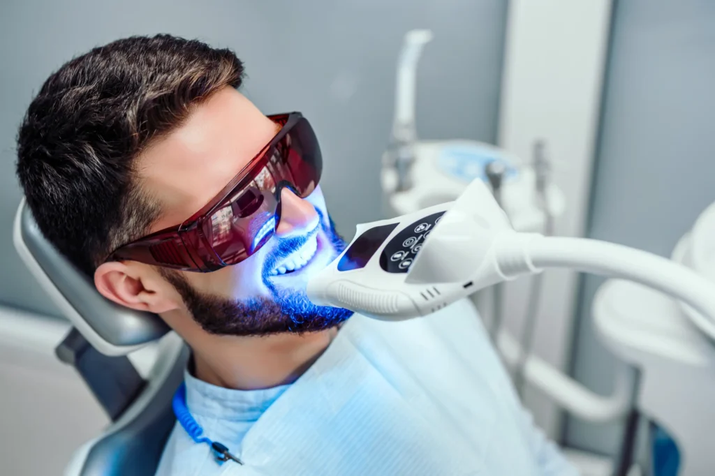 Clareamento Dental a Laser: como funciona e quais os resultados